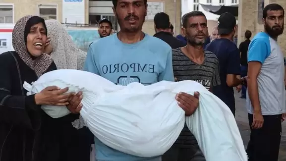 Varsayılan resim bulunamadı.